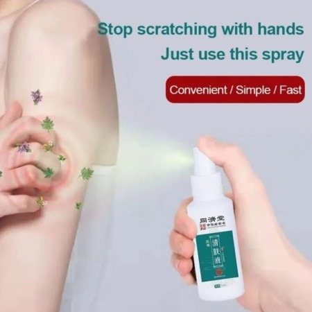 Antipruritic Tinea Nemesis (একজিমা)